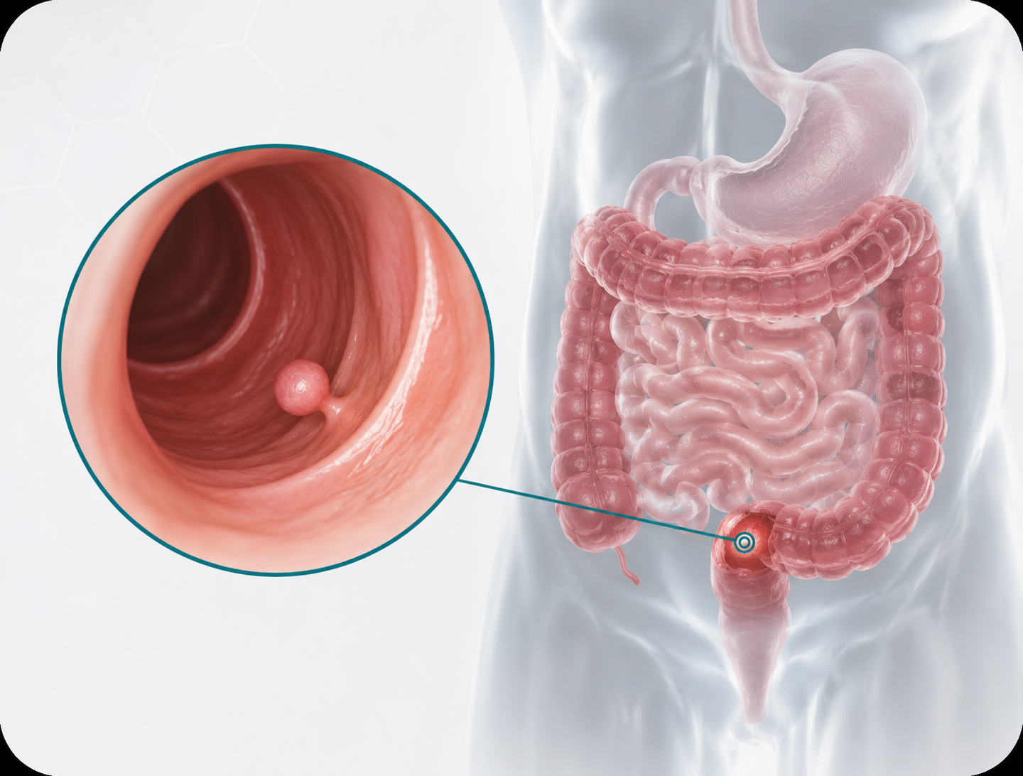 Cirurgia oncológica digestiva